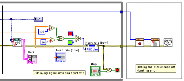 Bloc Diagramme 3