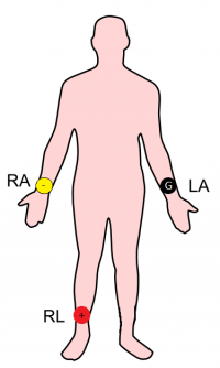 Raccordements